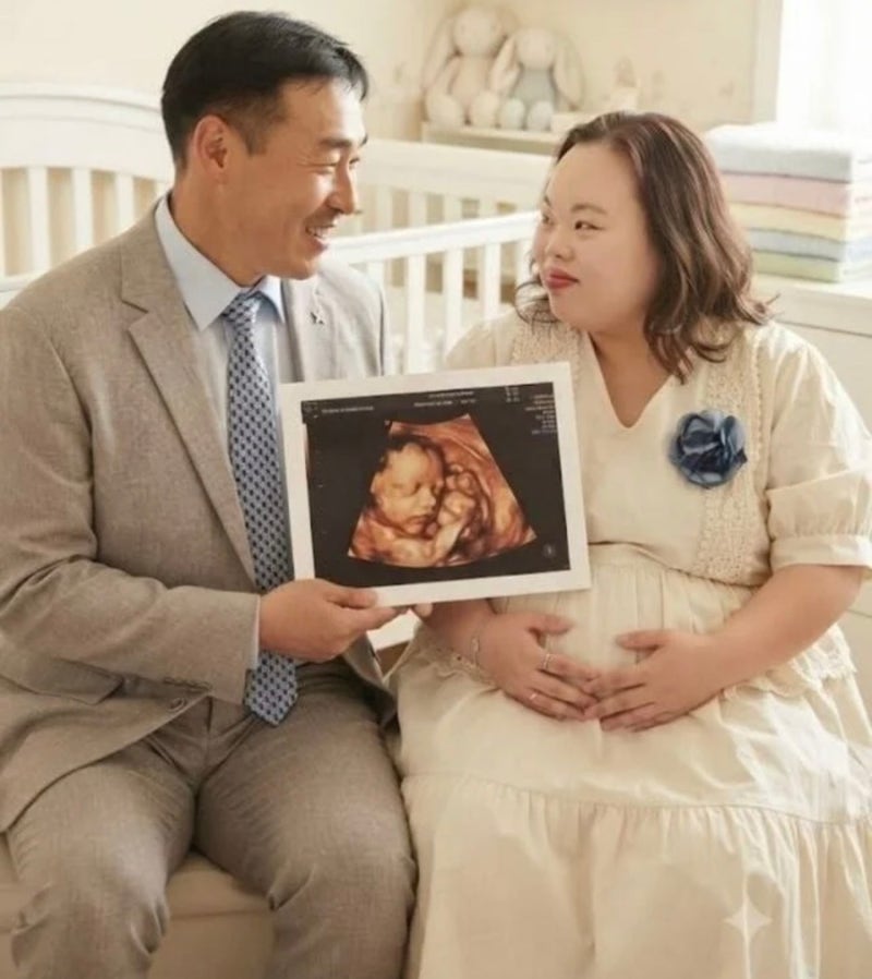 다운증후군 배우 서은혜 임신 발표, 남편 조영남 누구? 우리들의 블루스 정은혜 근황