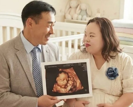 다운증후군 작가 서은혜 조영남 임신 발표 인스타