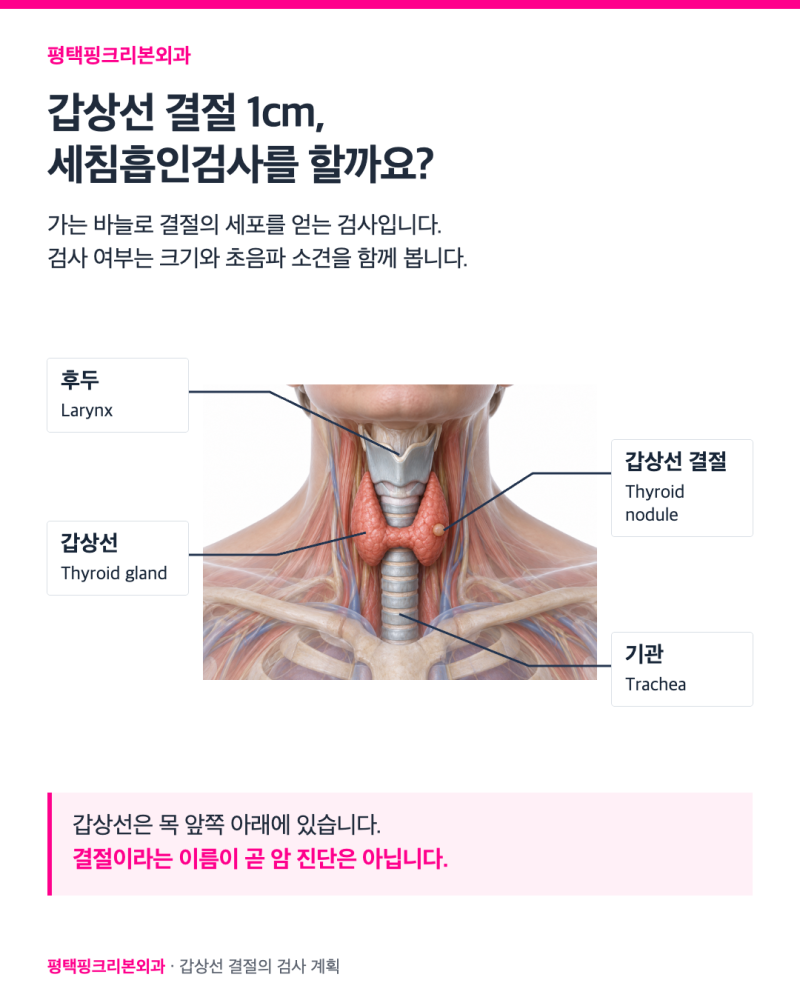 갑상선 결절 1cm, 세침흡인검사 여부가 달라지는 이유