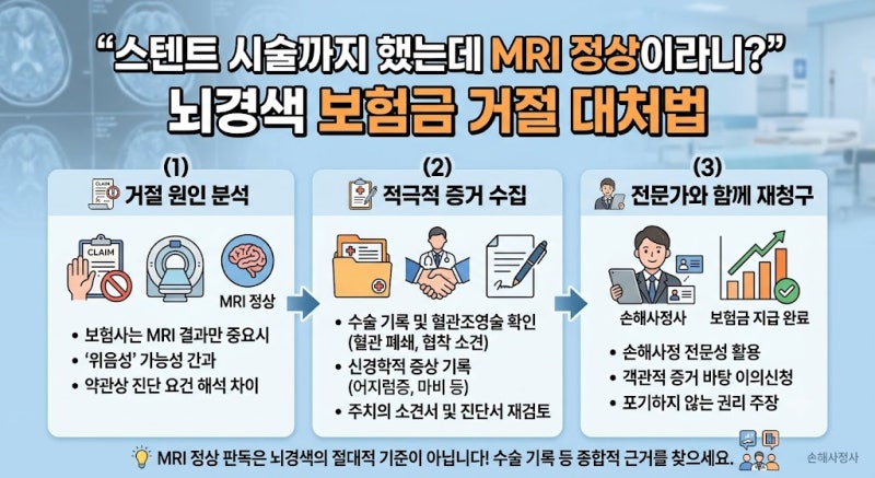 [보험정보] “스텐트 시술까지 했는데 MRI 정상이라니?” 뇌경색 보험금 거절 대처법