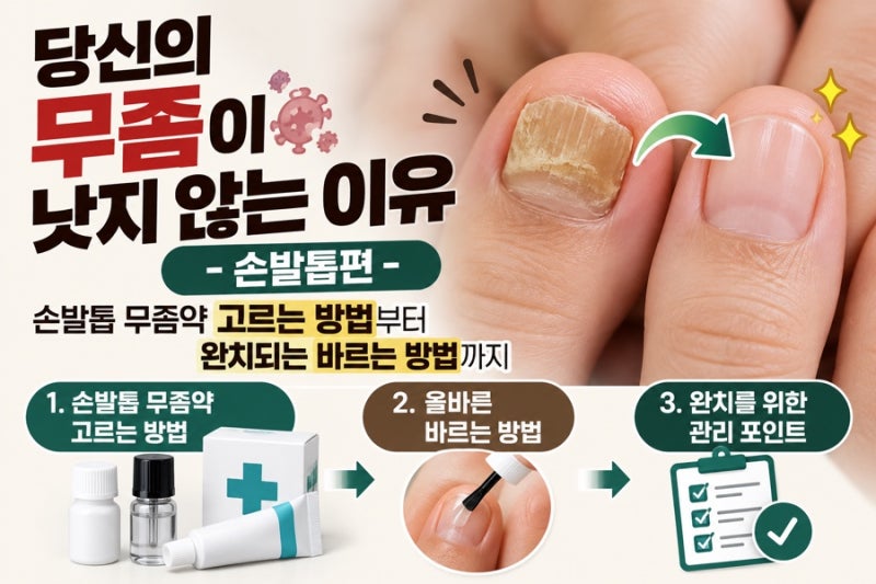 당신의 무좀이 낫지 않는 이유-손발톱편, 손발톱 무좀약 고르는 방법부터 완치되는 바르는 ....