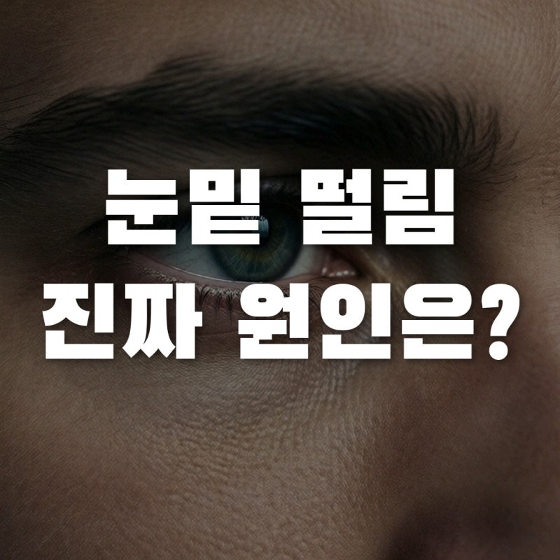 눈밑떨림원인 마그네슘 부족 탓만 했다면? 진짜 원인과 솔직 장단점 검증