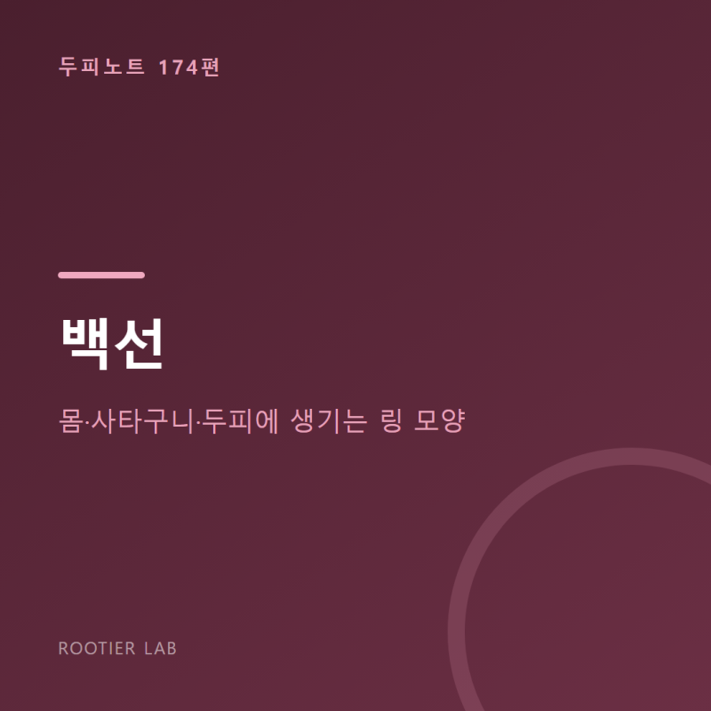 백선 — 몸·사타구니·두피에 생기는 링 모양