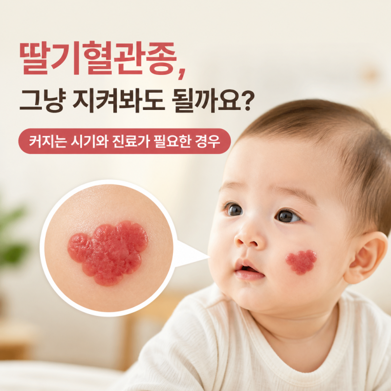 딸기혈관종, 그냥 지켜봐도 될까요? 커지는 시기와 진료가 필요한 경우