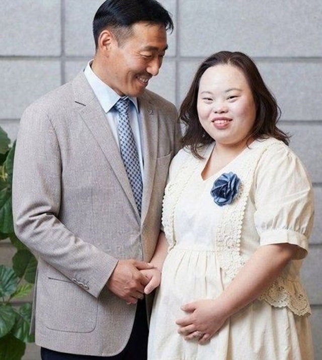 서은혜 다운증후군 작가 임신설 초음파 사진 공개에도 임신 여부는 아직 미확인