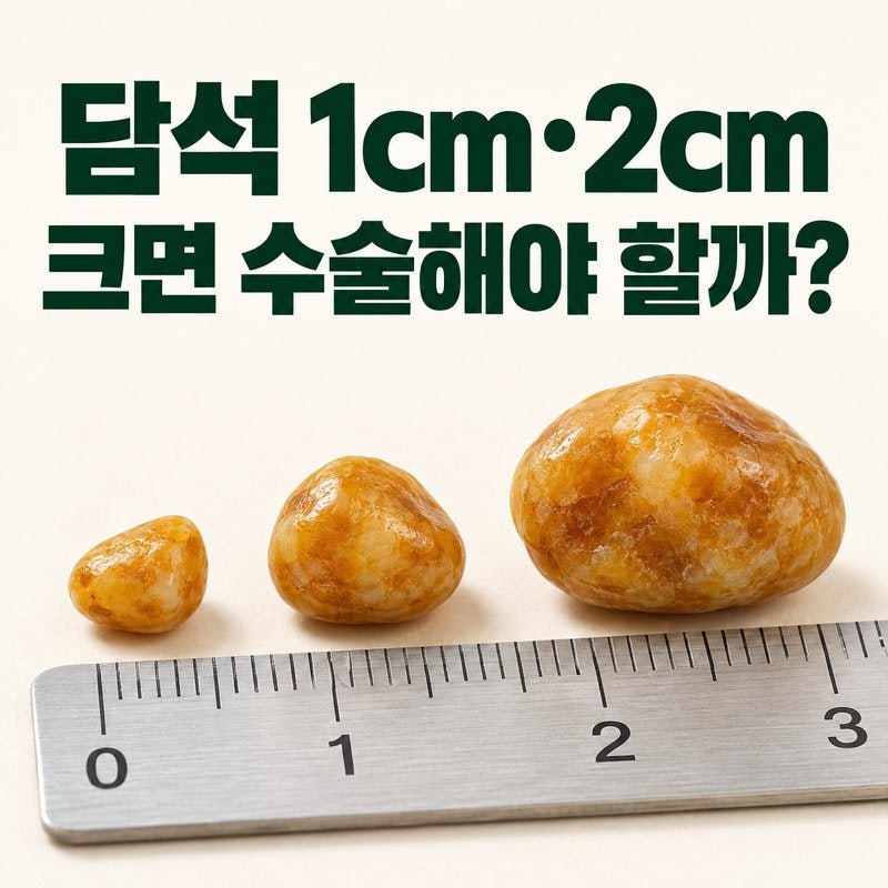 담석 1cm·2cm면 수술해야 할까｜크기보다 먼저 확인할 것