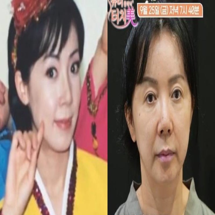 사업 실패+<b>이혼</b> 딛고…<b>김혜영</b>, 8년 만에 되찾은 피부 비결은?