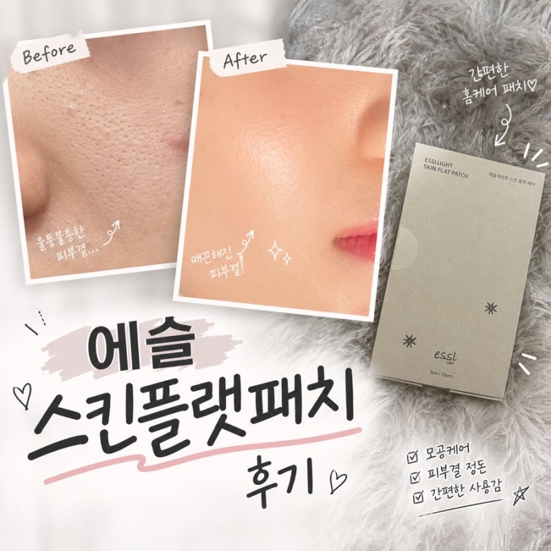 에슬 쥐젖패치 스킨플랫패치로 오돌토돌 피부요철 관리해본 후기