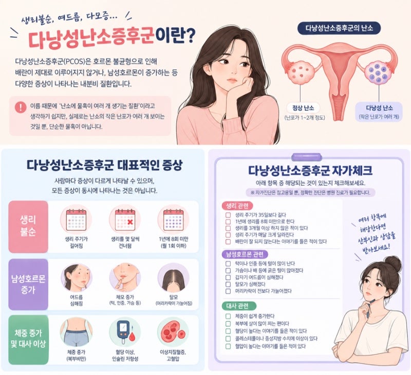 생리불순 혹시 나도 다낭성난소증후군?