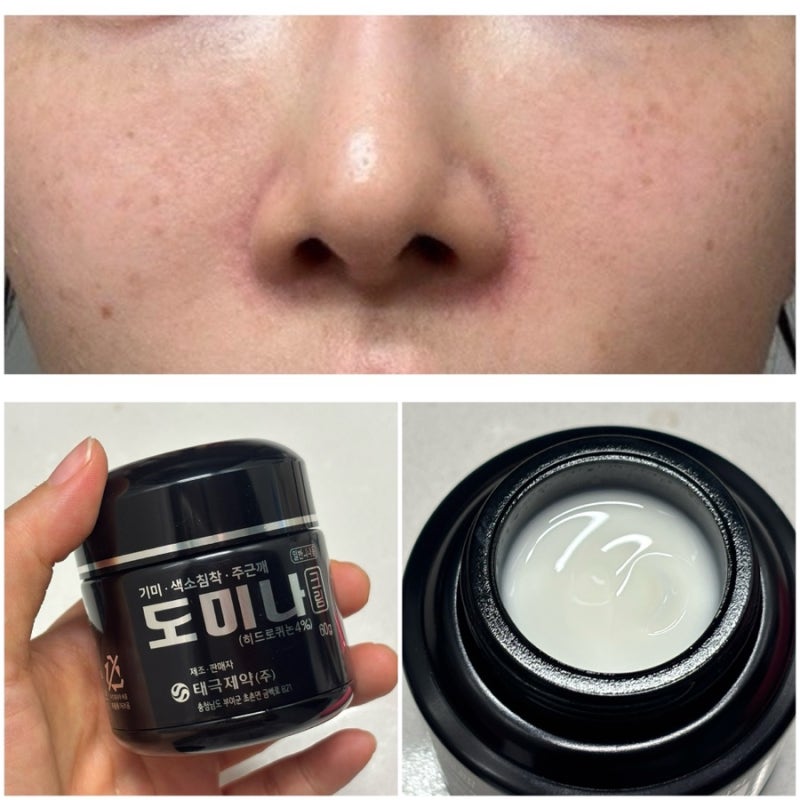도미나크림 진짜 기미 효과? 한달간 직접 써본 내돈내산 솔직리뷰 부작용까지