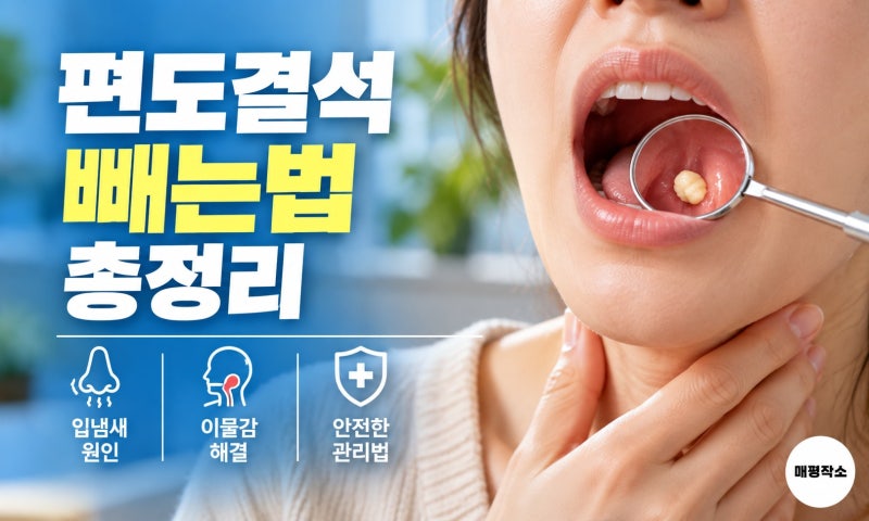 편도결석 빼는법 총정리, 소금물 가글로 되는 경우와 병원 가야 하는 경우