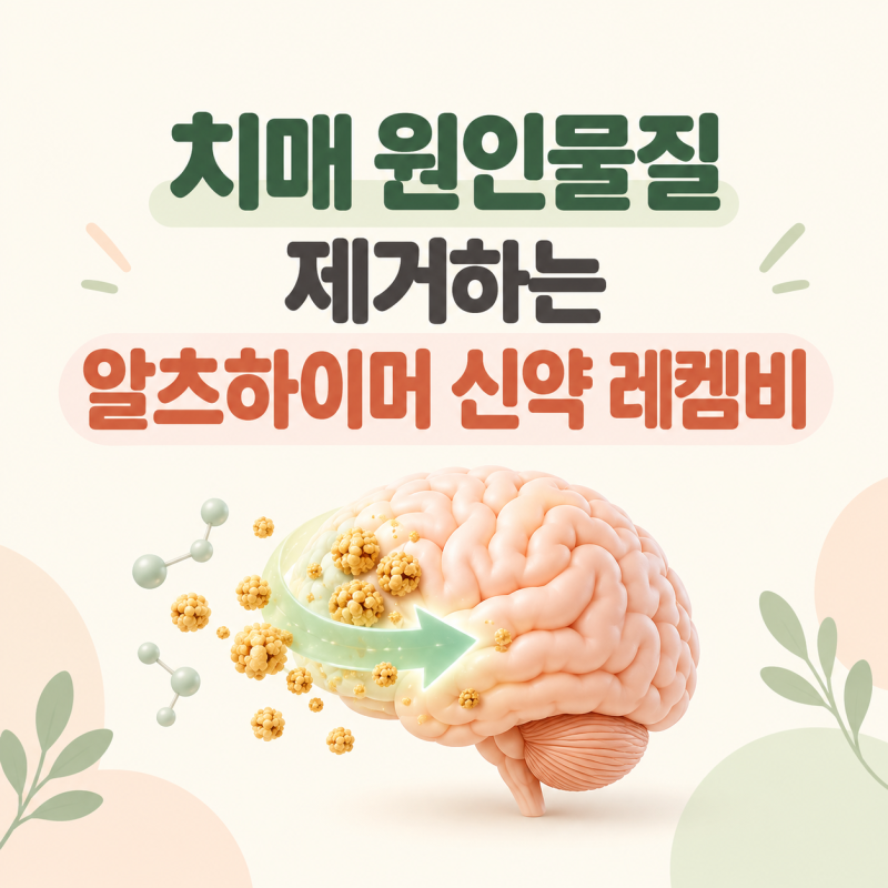 알츠하이머 신약 레켐비 국내 출시｜치매 원인물질 제거 효과와 치료 대상은?