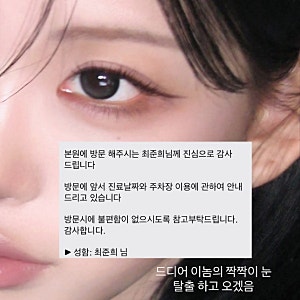 "성형은 살 빼고 하세요" 최준희, 3번째 눈 수술 후 확 달라진 근황 (+피눈물 조언)