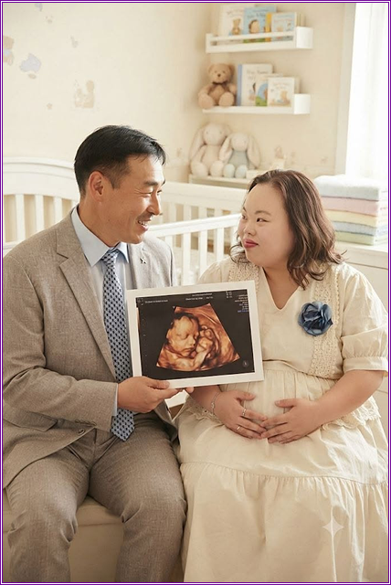 서은혜 조영남 부부 초음파 사진 공개, 이혼설 두 달 만에 전해진 근황