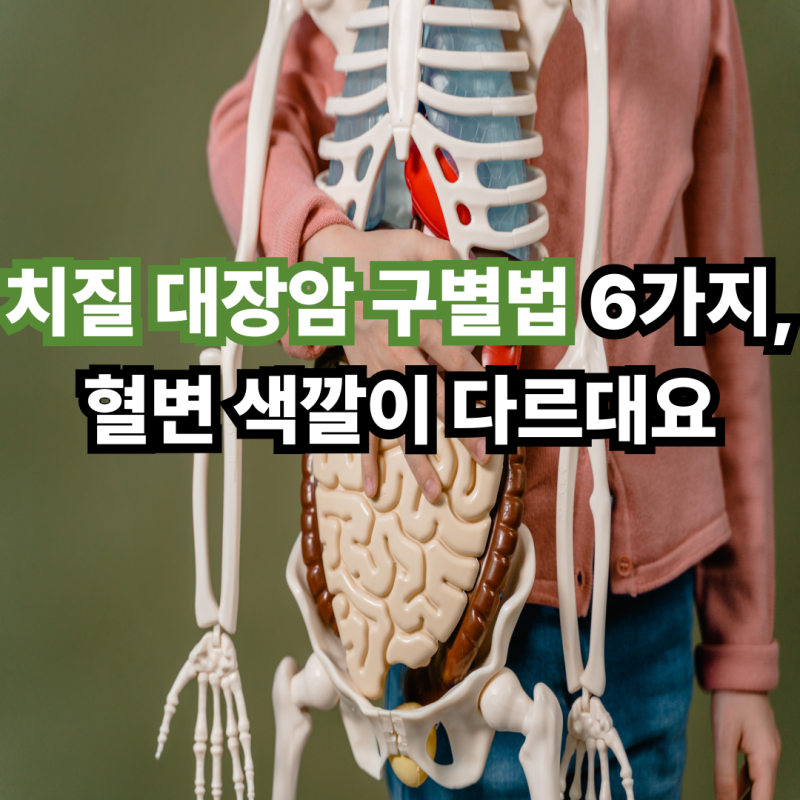 치질 대장암 구별법 6가지, 혈변 색깔이 다르대요