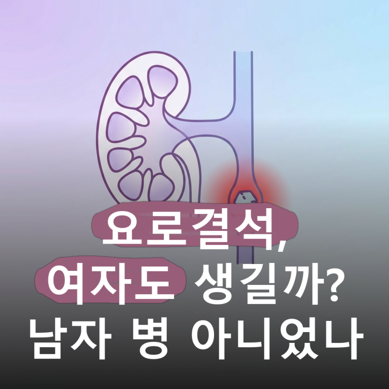 남자 병으로 알려져 있지만 2배 차이일 뿐입니다.. 요로결석, 여자도 생기는 이유와 감염이 ....