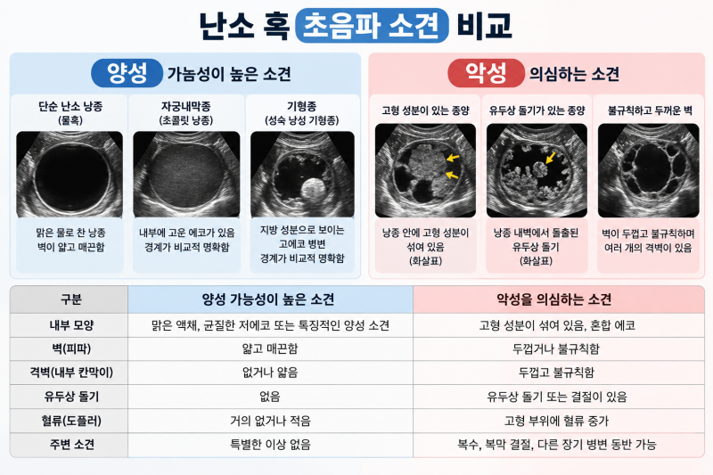 난소에 혹이 있다고 합니다. 난소암인지 어떻게 구별할까요?