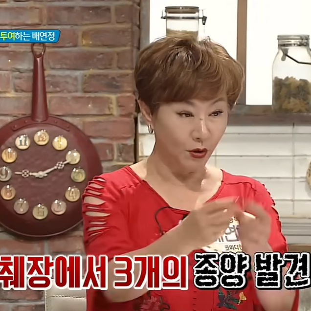 배연정 췌장 전조증상 무시했다가 13cm 절제, 이후 매일 먹는 음식은?