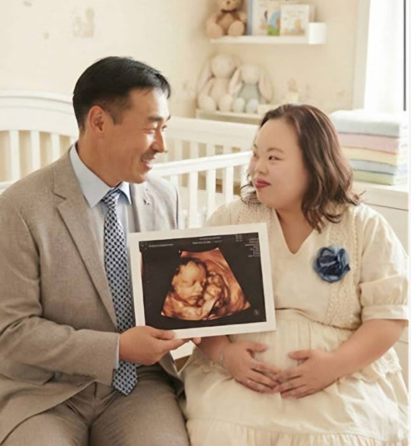 다운증후군 작가 임신한 줄 알았는데 서은혜, 조영남 父 초음파 사진은 AI
