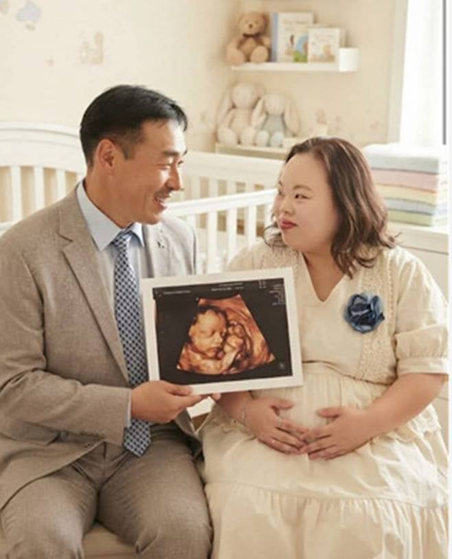이혼설 극복한 서은혜 조영남, 이번엔 임신설…초음파 사진 공개 후 돌연 삭제