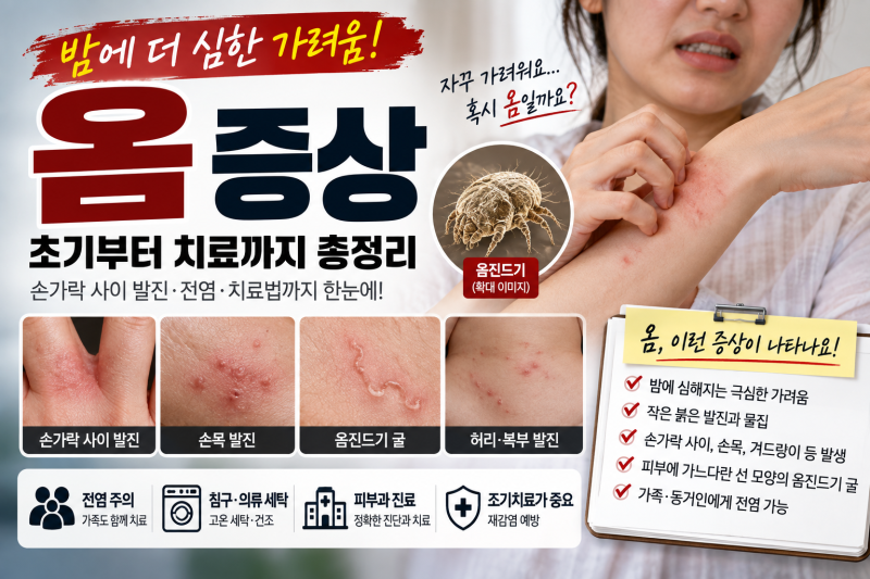 옴 증상 초기부터 치료까지 총정리, 밤에 심한 가려움 주의