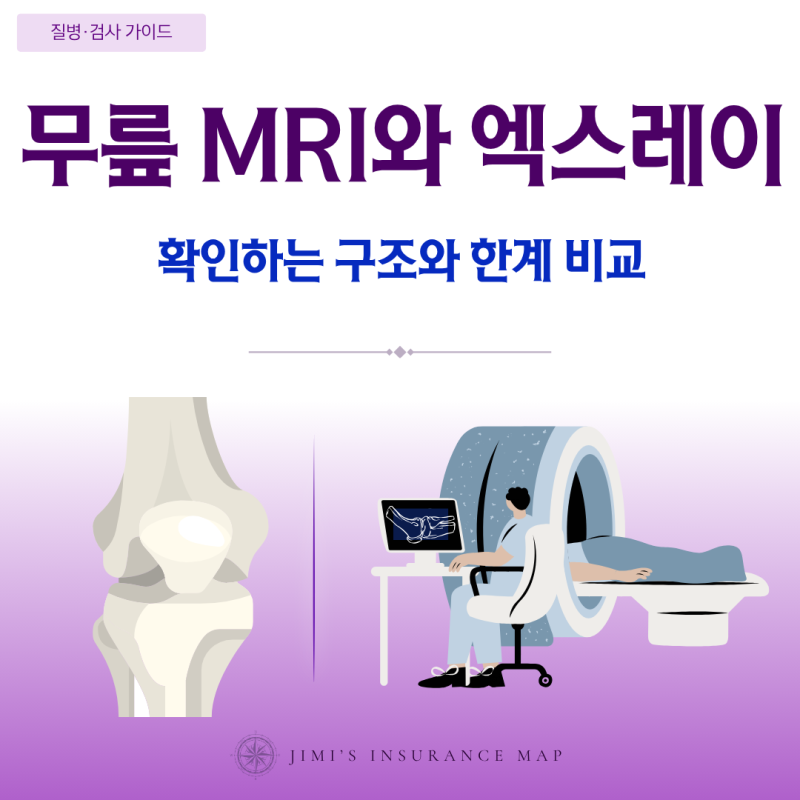 무릎 MRI와 엑스레이 차이, 각각 무엇을 확인하고 어떤 한계가 있을까?