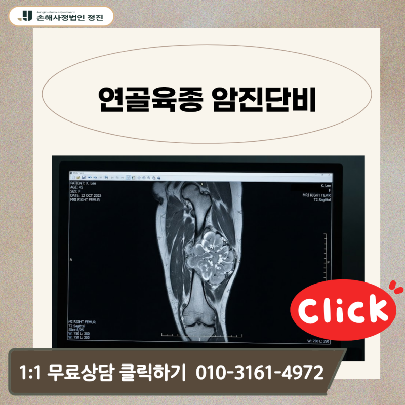 연골육종 암진단비, C40 C41 코드 받고도 왜 경계성종양으로 삭감될까?