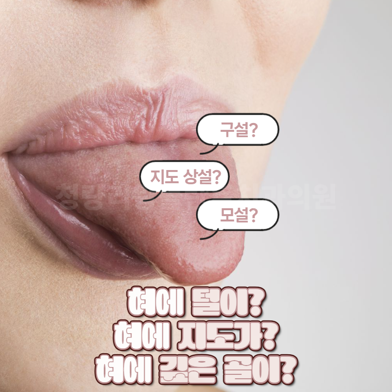 혀에 털이? 혀에 지도가? 혀에 깊은 골이? (ft. 지도상설, 구설, 모설)