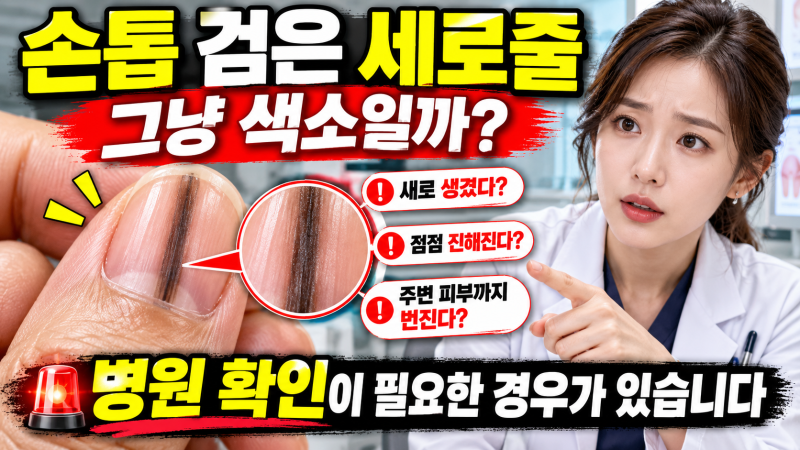 손톱에 검은 세로줄, 그냥 색소일까? 병원 확인이 필요한 경우가 있습니다