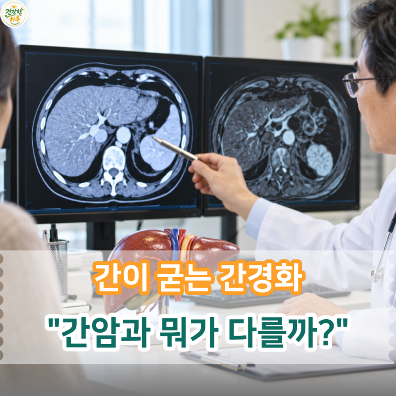간경화와 간암 같은 병일까? 미리 알아둘 결정적 차이