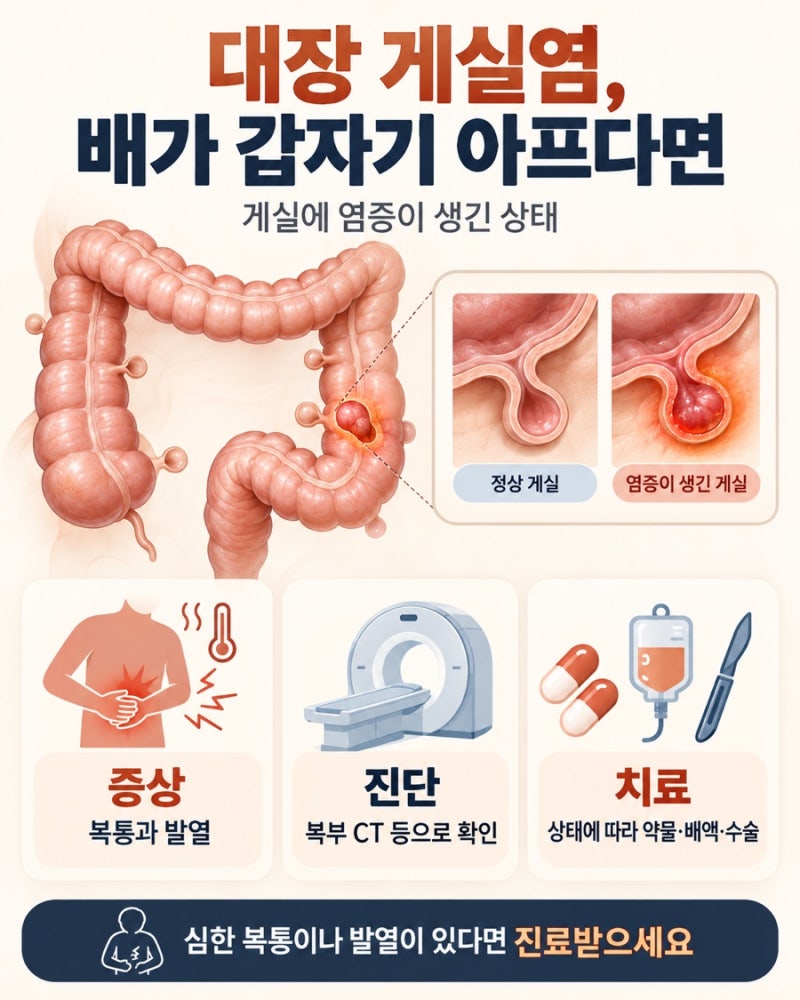 대장 게실염, 갑자기 배가 아프다면 확인하세요