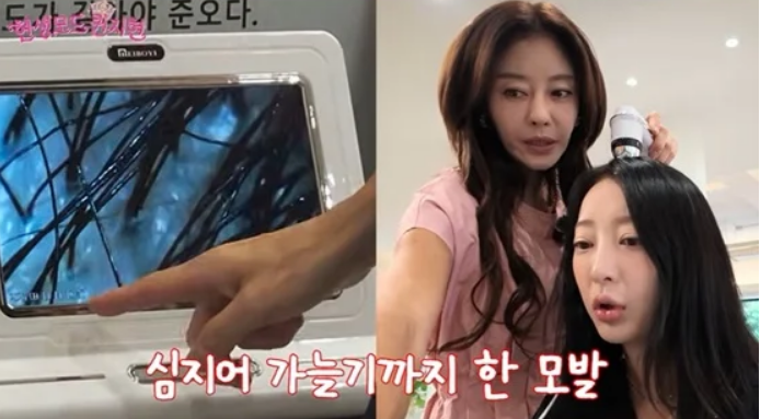 EXID 혜린, 탈모 의심에 충격 붉은 두피·염증까지 확인