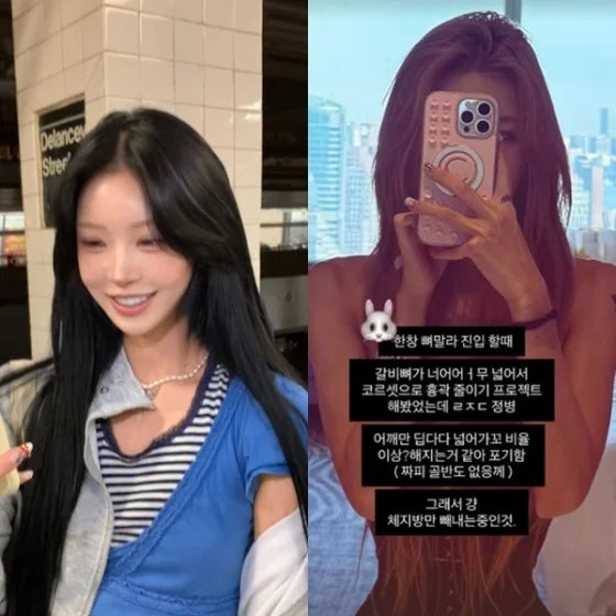 최준희 41kg 근황에 관심 집중…흉곽 줄이기를 포기한 이유와 성형 조언