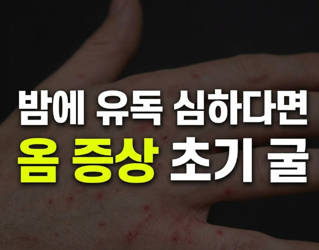 옴 증상 초기 사진으로 보는 특징과 잠복기, 원인부터 치료 약까지