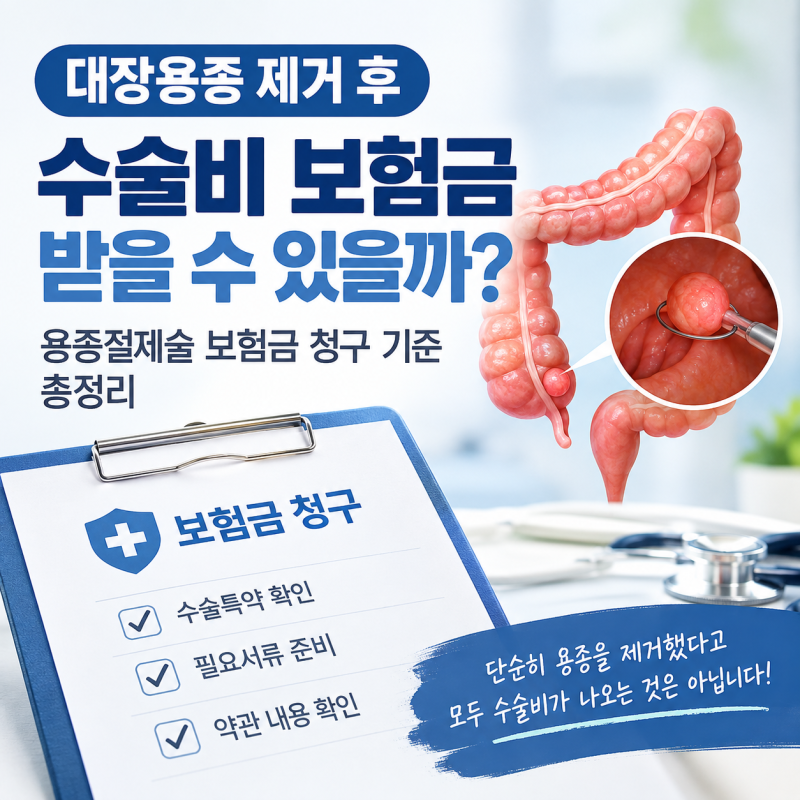 대장용종 제거 후 수술비 보험금 받을 수 있을까?｜용종절제술 보험금 청구 기준 총정리