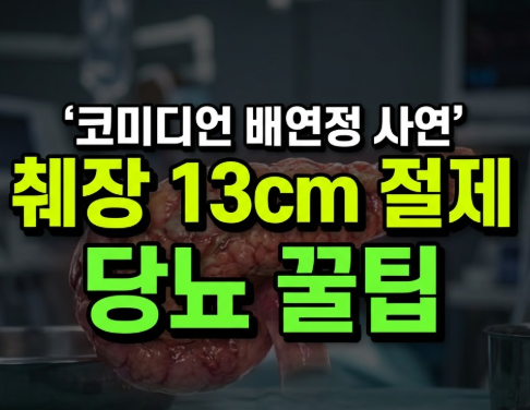 배연정 췌장 13cm 절제 수술과 배연정 췌장 음식, 26년째 당뇨 관리 비결