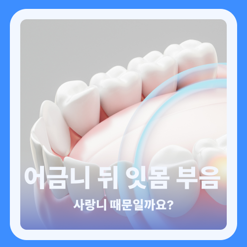 어금니 뒤 사랑니 잇몸 부음, 사랑니 때문일까요? 운정 사랑니 검사 기준
