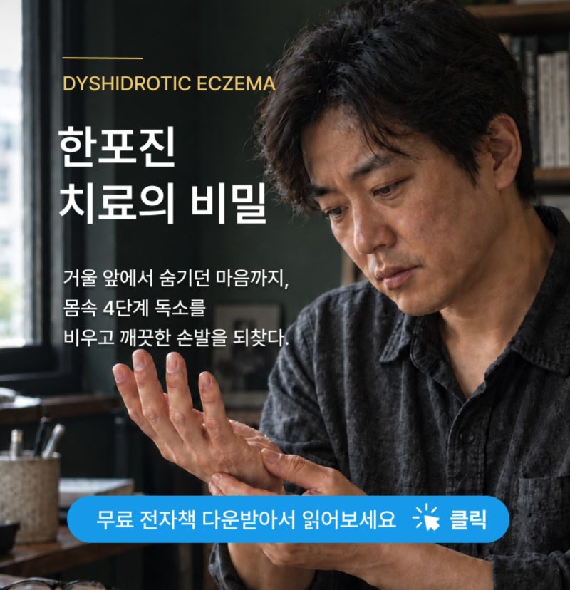손가락 한포진 연고, 처방받을 때 무엇을 확인해야 할까요?