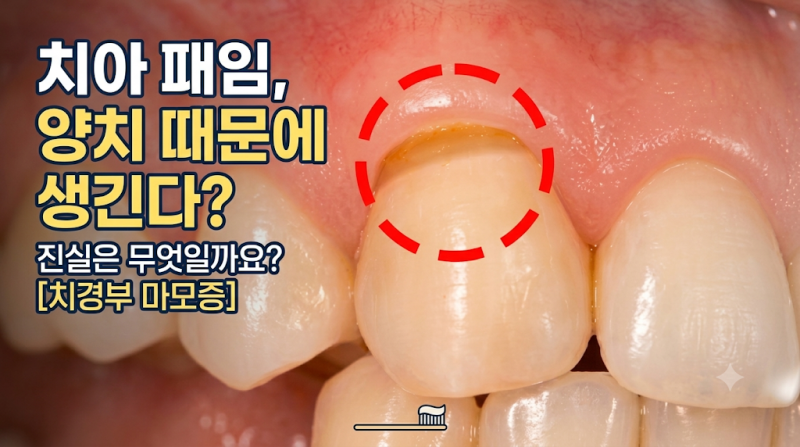 [치통/시린이] 치아 파임 원인과 단계별 치료법 (레진, 신경치료, 관리법 총정리)
