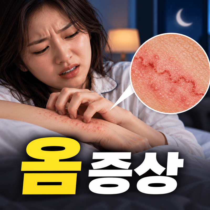 옴 증상, 밤마다 미친 듯 가렵다면? 가족까지 번지기 전 확인해야 할 신호