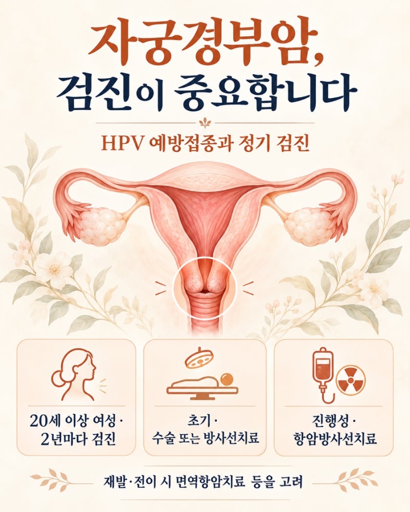 자궁경부암, 증상이 없어도 검진이 중요한 이유