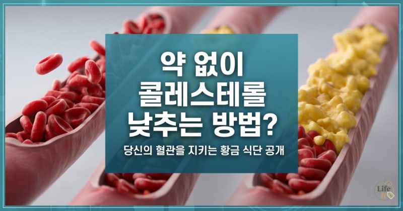 약 없이 고지혈증 낮추는 식단 가이드 (좋은 음식과 피해야 할 음식 총정리)