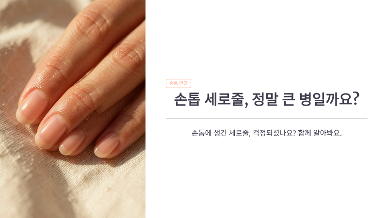 손톱 세로줄 생기는 이유, 건강 이상 신호라는 말 사실일까?
