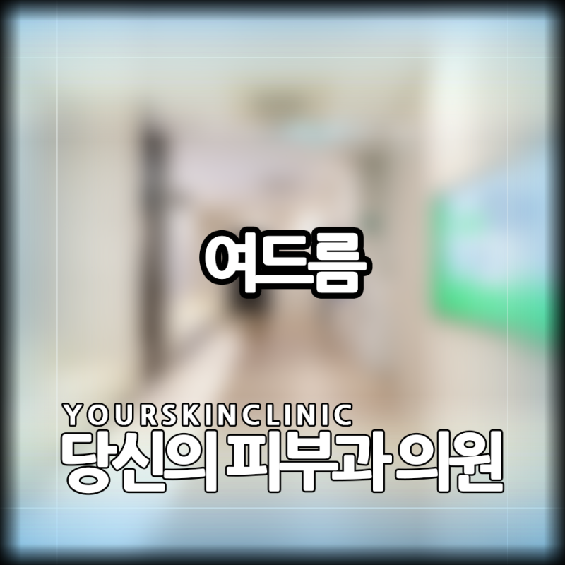여드름아그네스 받으면 더 이상 올라오지 않을까?