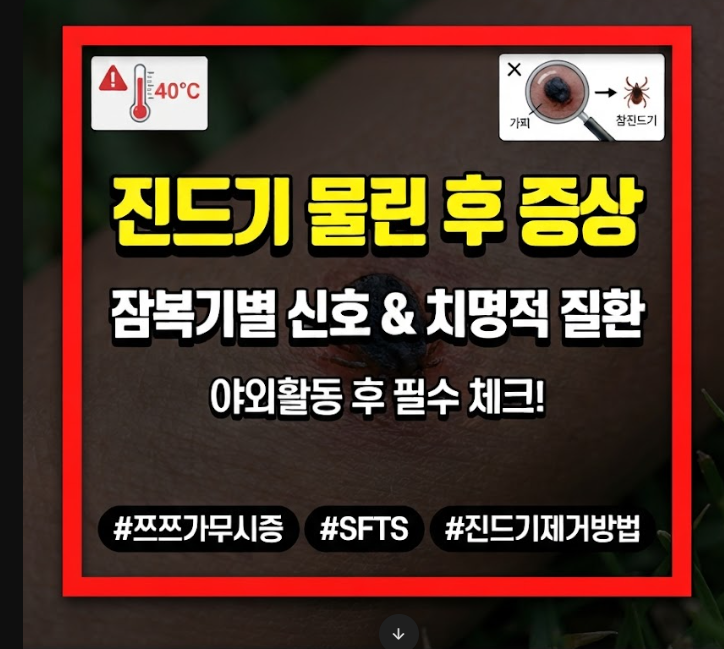 진드기 물린자국 종류 구분법, 검은 딱지·병원 기준