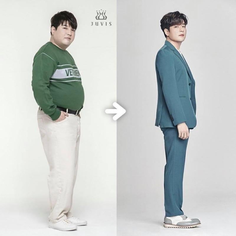 슈퍼주니어 신동 "37kg 빼고도 유지 중?" 요요 없이 달라진 최근 몸매 비결 공개