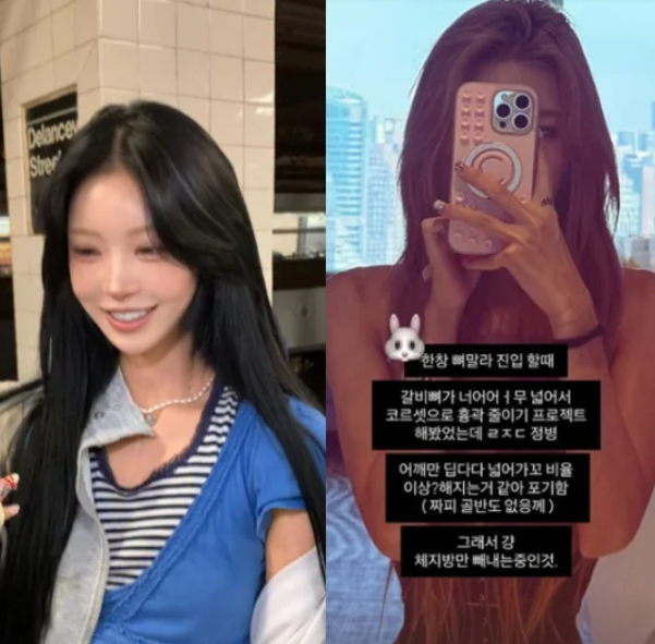 "흉곽 줄이려다 레전드 정병…" 23세 최준희, 170cm·41kg '뼈말라' 고백 충격