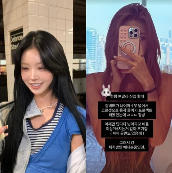 "갈비뼈까지 줄이려고?" 41kg 최준희, 코르셋으로 흉곽까지 줄이려다 결국 포기