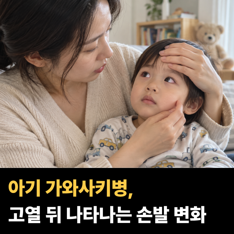 아기 고열에 눈까지 빨개졌다면… 가와사키병에서 함께 확인하는 증상