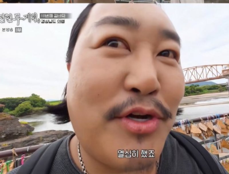 조째즈 눈 코 입 다 손봤다 성형 1세대 고백 최근엔 치아까지 솔직 공개